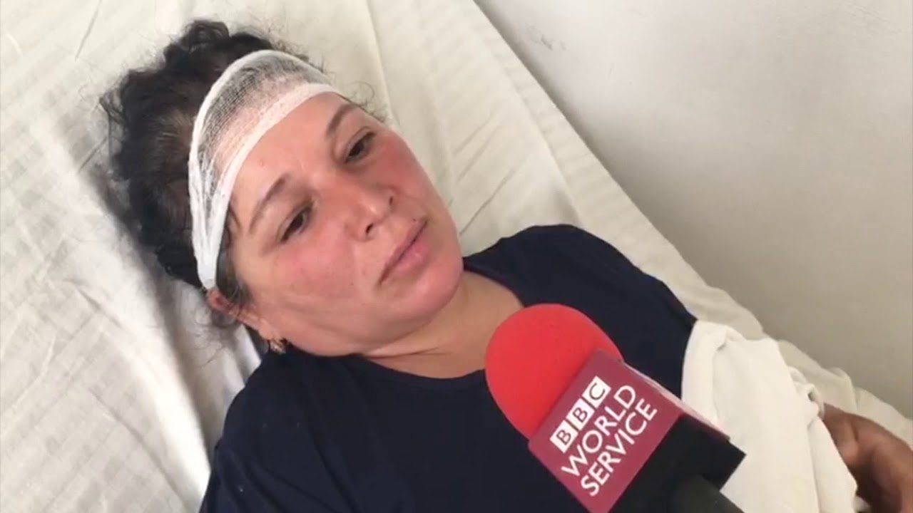 İmişlidə pambıqçıların zəhərlənməsi: 
