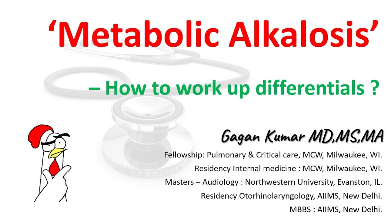 Metabolic alkalosis - How to work up differential diagnosis ?