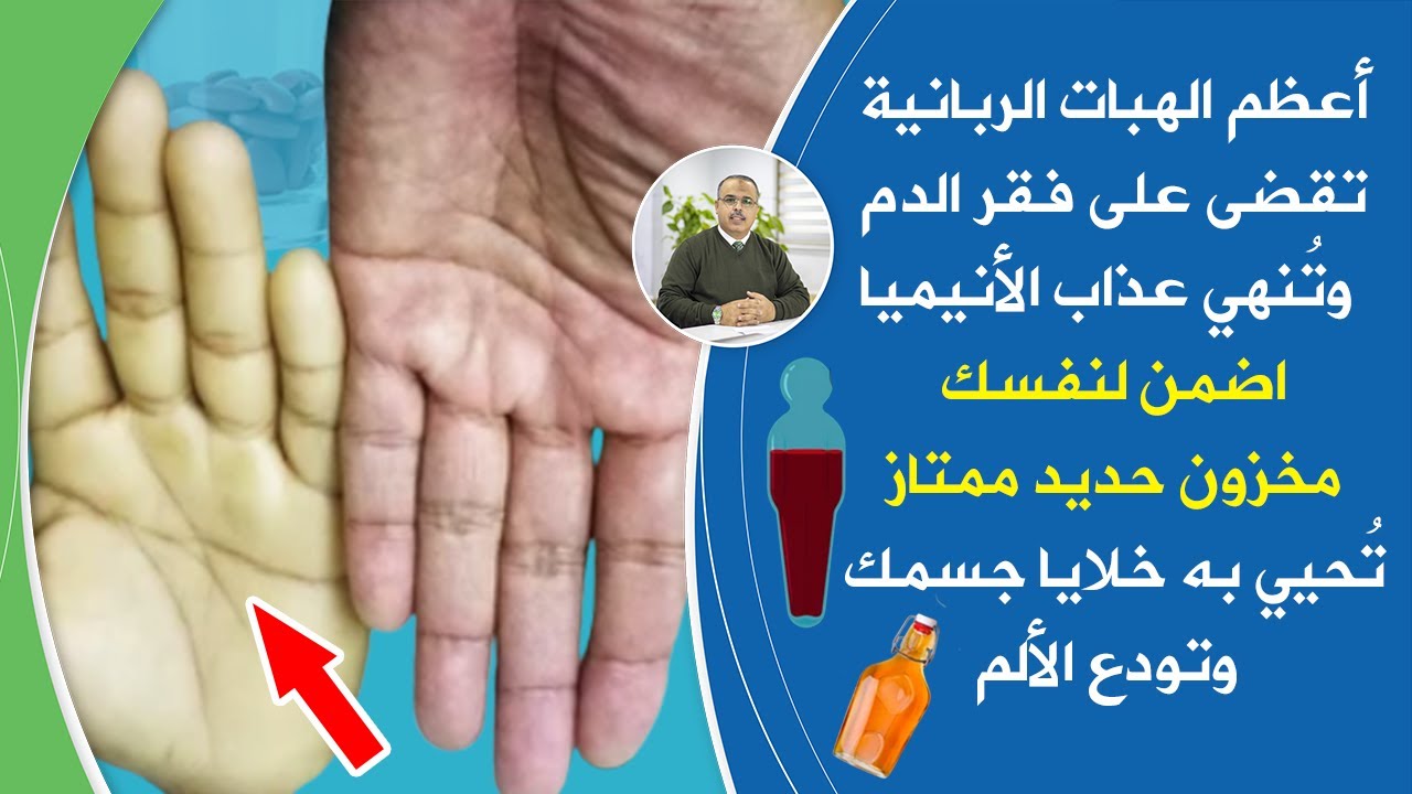 نعمة ربانية تعالج فقرالدم والانيميا نهائيا ترفع مخزون الحديد بقوة تنهي عذاب عوارض فقر الدم والأنيميا