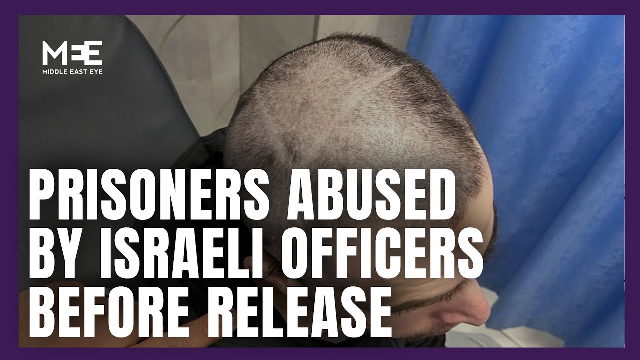 Israeli prison releases Palestinian with Star of David shaved on to his head