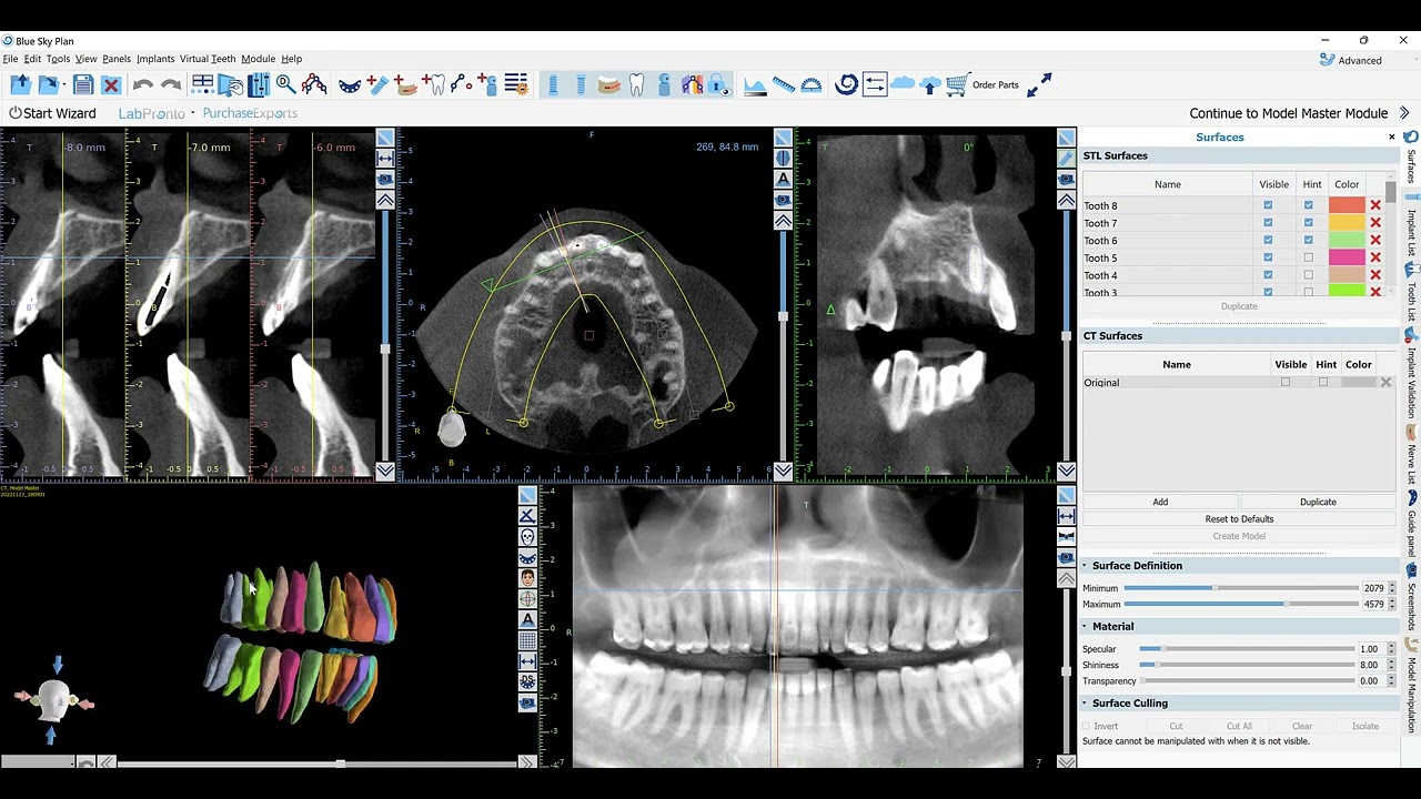 New BSP AI Tooth Segmentation - First Look