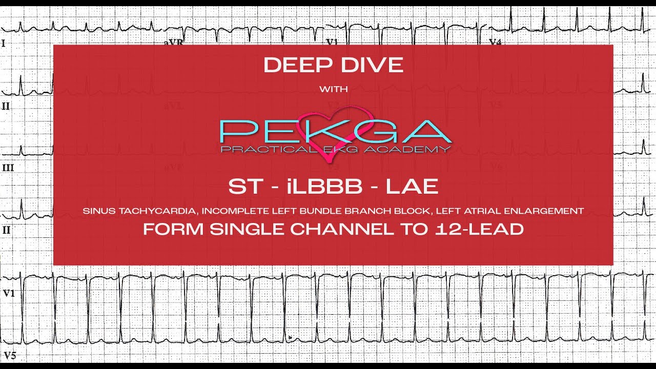 DEEP DIVE - SINUS TACHYCARDIA, INCOMPLETE LEFT BUNDLE BRANCH BLOCK, LEFT ATRIAL ENLARGEMENT - PEKGA