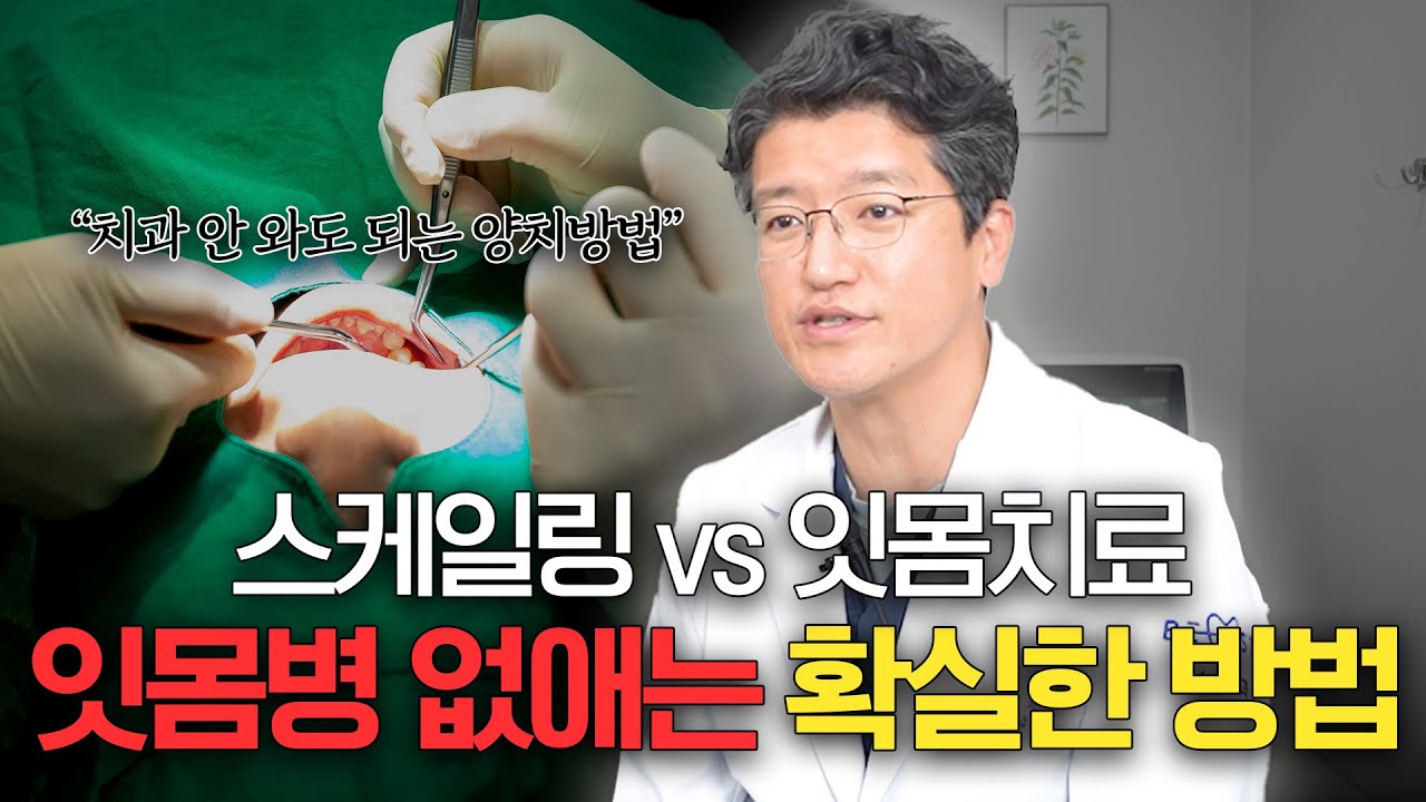 치과에서 말 안 해주는 가성비 시술🦷 스케일링, 잇몸치료 (feat. 치과 안 가는 방법까지?)