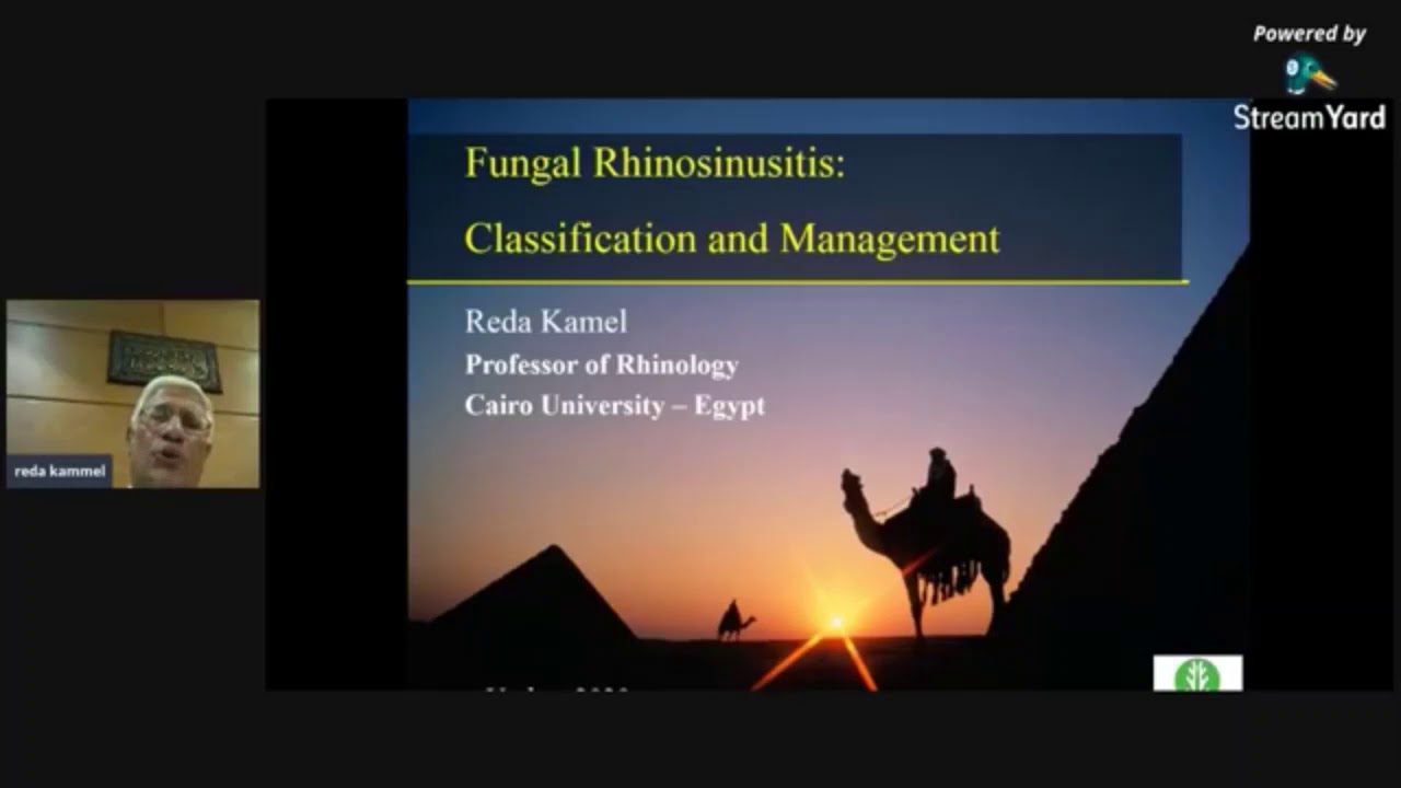 Management of Fungal Sinusitis- Prof.Reda Kamel