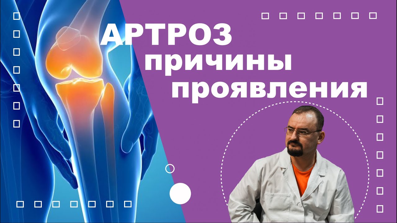 Артроз сустава - постарение. Причины и проявления артроза.