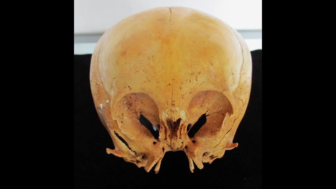 The Enigmatic Ancient Humanoid Skulls Of Paracas Peru