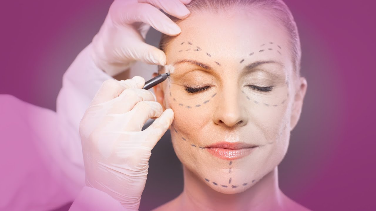 Endoscopic Face Lift: A Minimally Invasive Approach to Youthful Rejuvenation
