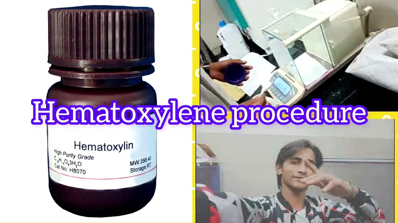 How To Make Hematoxylene Stain In Histopatholagy || vlogger KF 🖐
