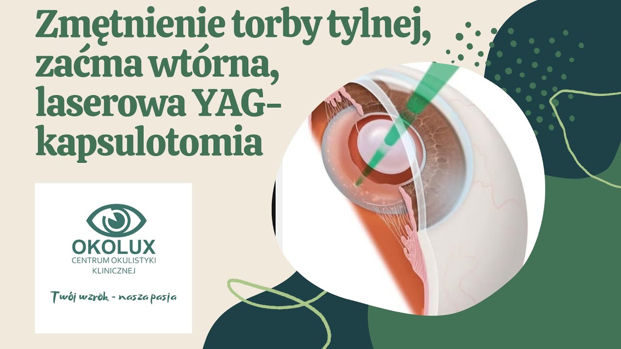 Zmętnienie torby tylnej, zaćma wtórna, YAG kapsulotomia