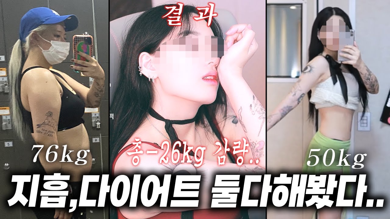 총 -26키로 뻈습니다 지방흡입,다이어트 둘 다 해본 여캠의 3년간의 고도비만 탈출기