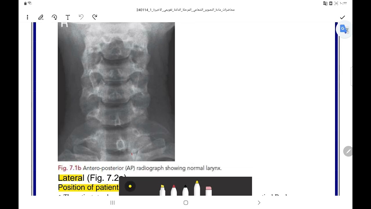 تصوير الحنجرة larynx 