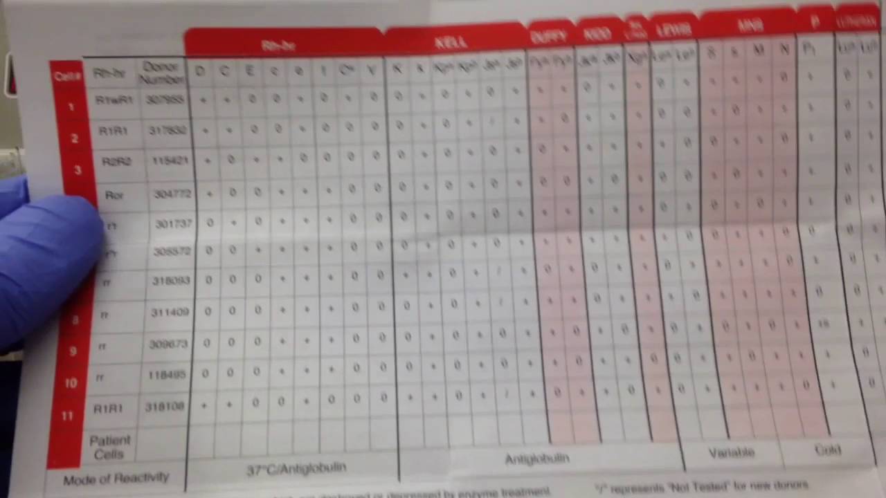 Blood Bank- Rhogam Antibody ID Panel