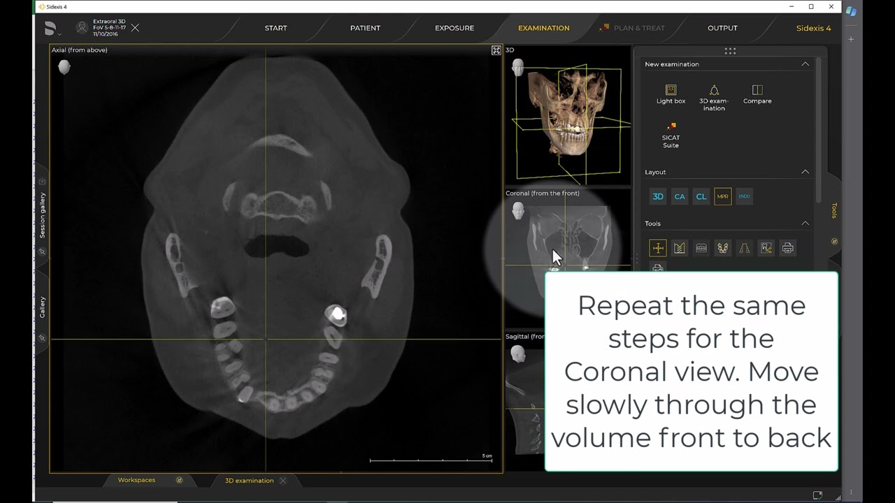 Imaging Training Session 27: Sidexis 4 – MPR Layout