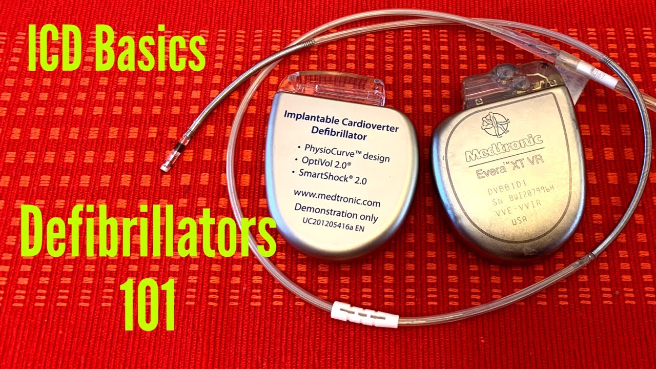 Defibrillators 101 - The Basics Of An Implantable Cardioverter Defibrillator (ICD)
