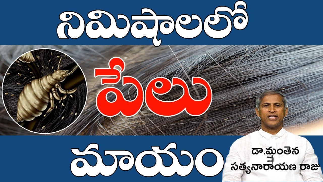 ఒక్కరోజులో పేలు పోయే సింపుల్ టెక్నిక్| How to Reduce Head Lice | Manthena Satyanarayana| #GoodHealth