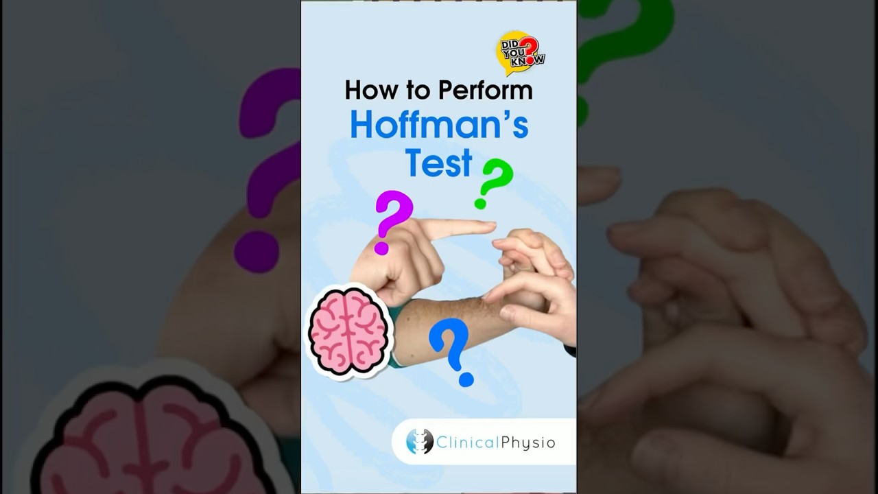 Hoffman Test #physiotherapy #physicaltherapy #spinalcordinjury #neuroexam #neurophysiotherapy