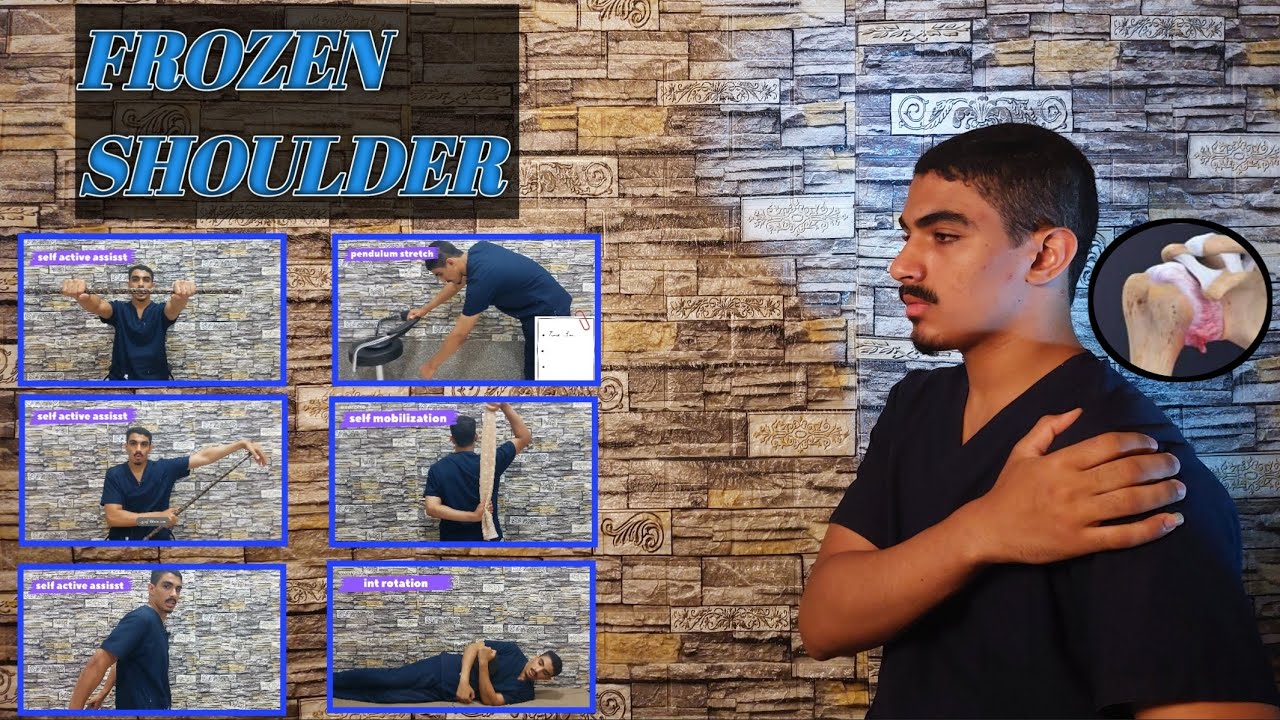تيبس مفصل الكتف《تجمد الكتف 》||7 تمارين لعلاج آلام الكتف || Frozen shoulder