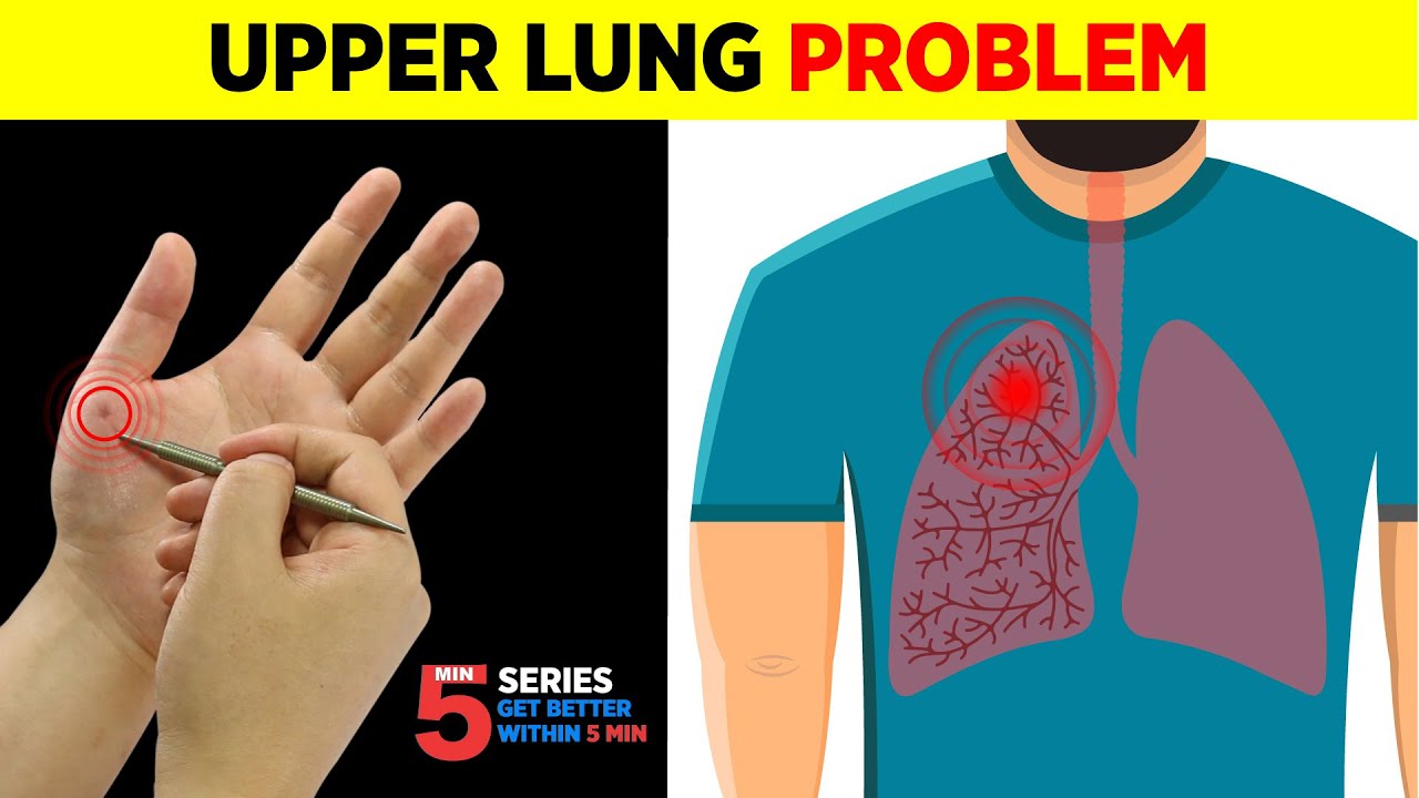 Sujok Treatment FOR LUNG PROBLEMS, Viral Infection, FLU, COPD, SHORTNESS OF BREATH🙍🏻&zwj;♂️🔥