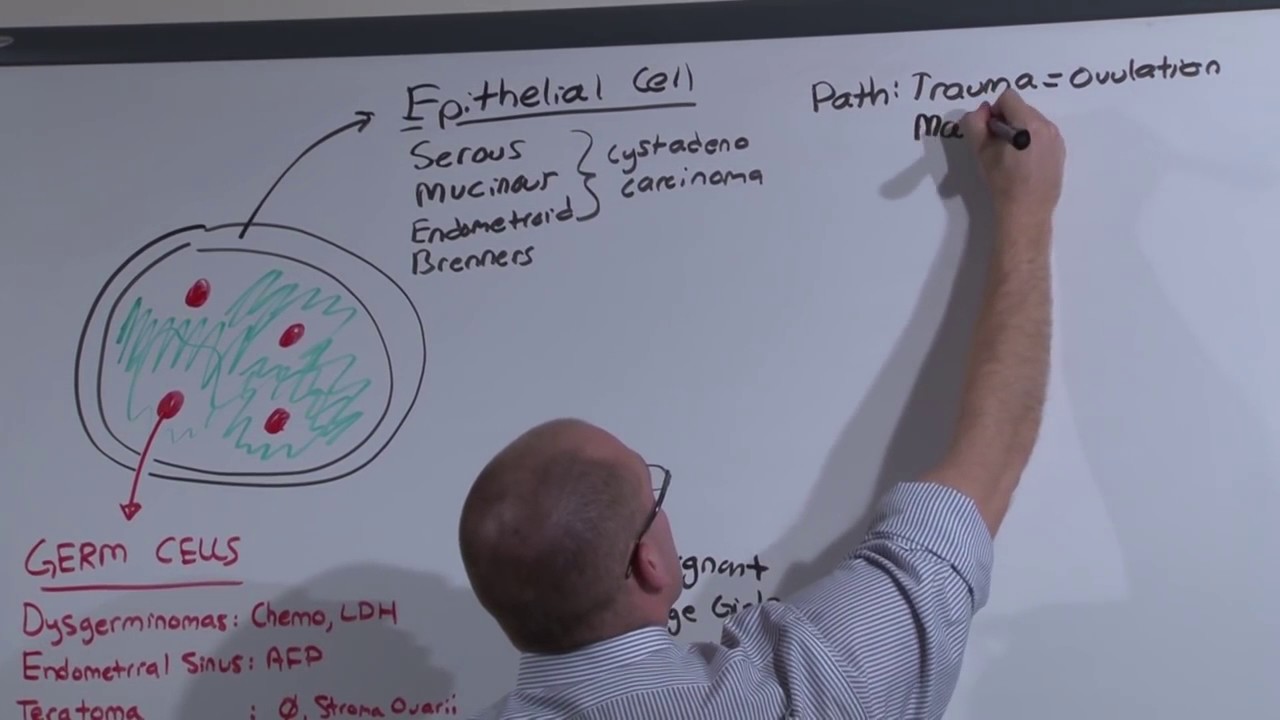 Gyn  Ovarian Cancer The Medical Education