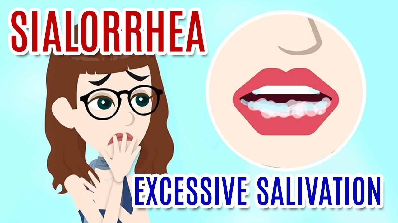 SIALORRHEA (EXCESSIVE SALIVATION): Causes, Diagnosis and Treatments