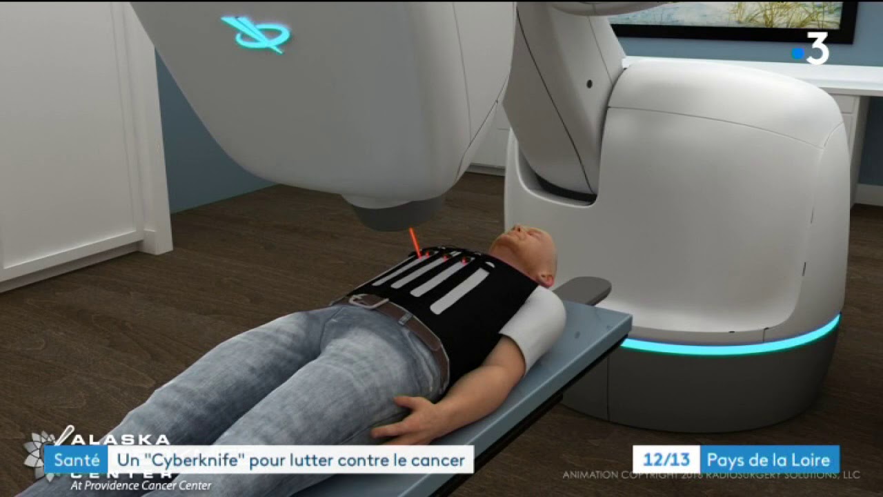 Cyberknife : le nouvel outil du centre de cancérologie du Mans