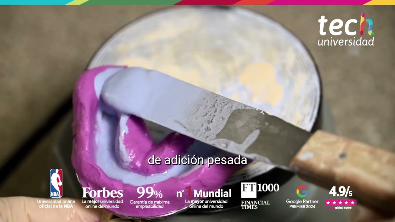Materiales en ortodoncia lingual: selección clínica para tratamientos precisos y estéticos