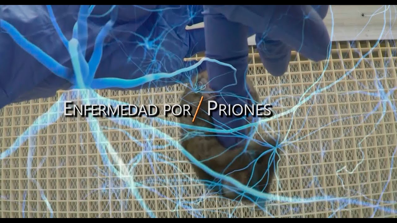 Enfermedad por Priones
