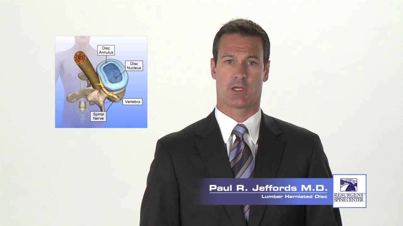 Lumbar Herniated Disc - Paul R. Jeffords M.D.