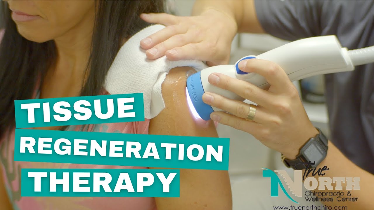 Incredible Recovery with Tissue Regenerative Therapy | True North Chiropractic & Wellness Center