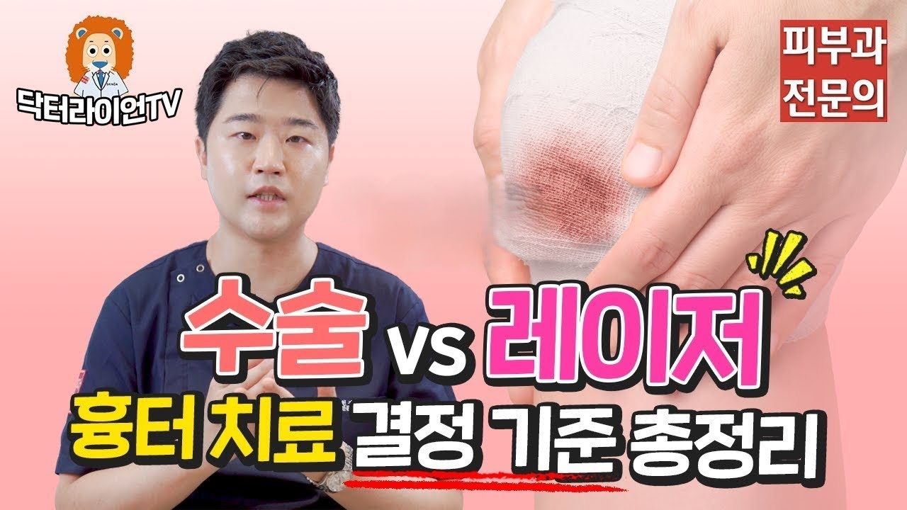 [수술외상흉터 정복 7탄] 흉터 제거 수술 VS 레이저 전격 비교! 결정 기준 총정리