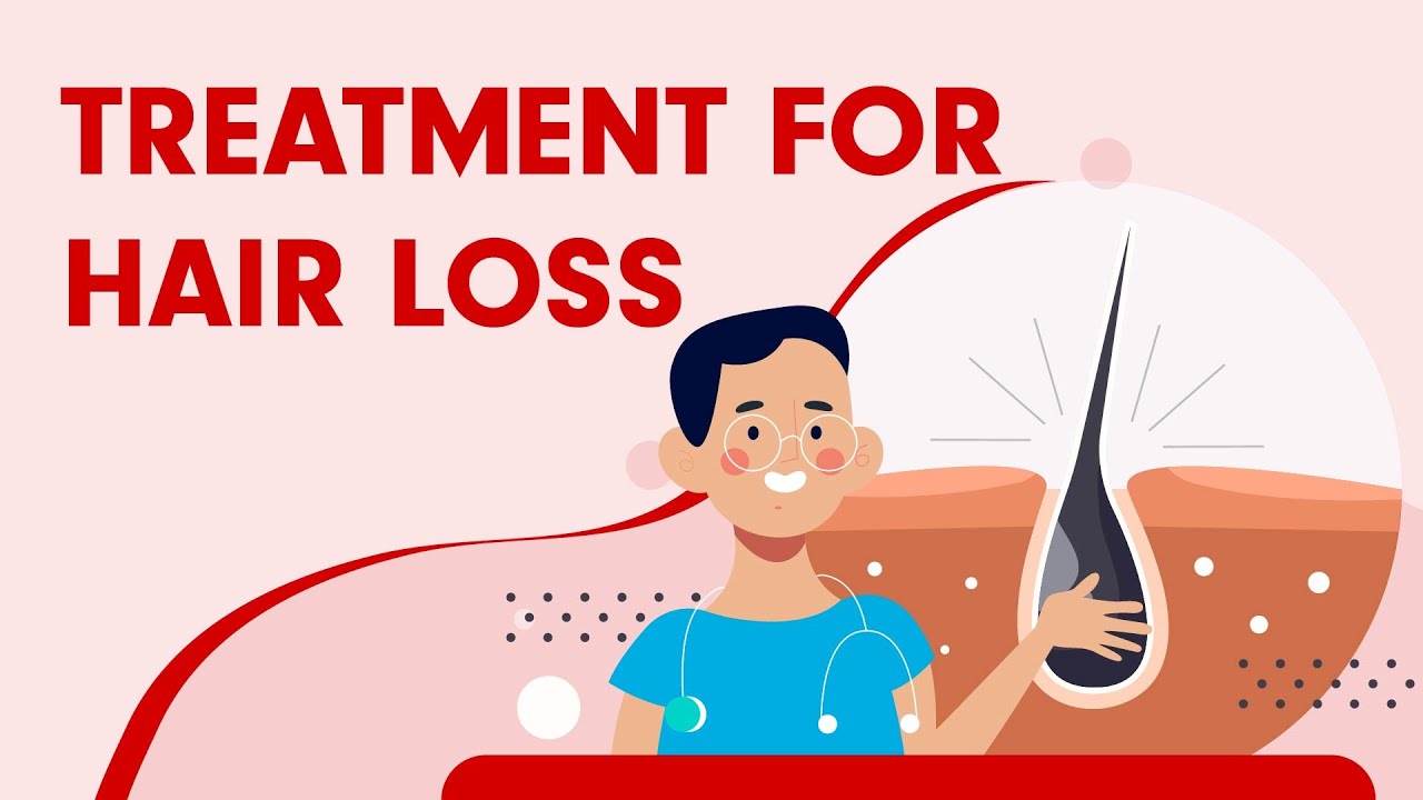 Treatment of Hair loss | My Healthytude