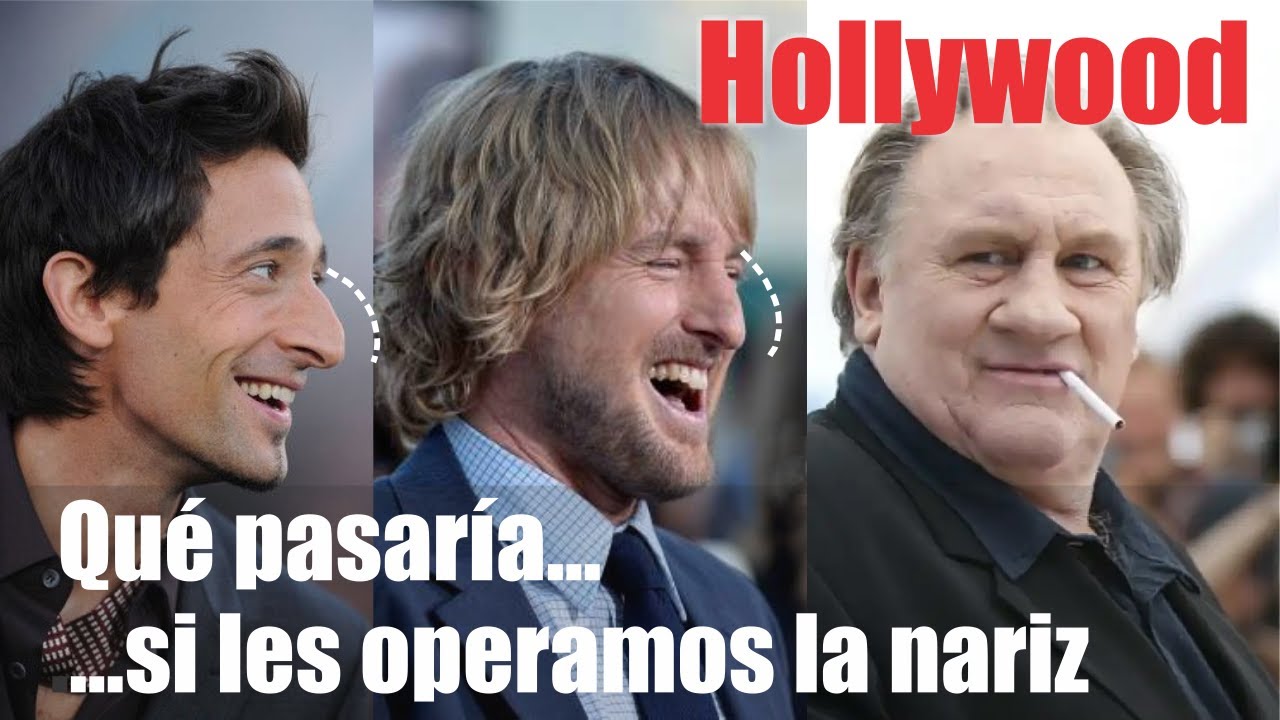 HOLLYWOOD: Cómo se verían con una RINOPLASTÍA?👃🏼Tipos de nariz  🤩 DR ALBERTO CALVO QUIROZ