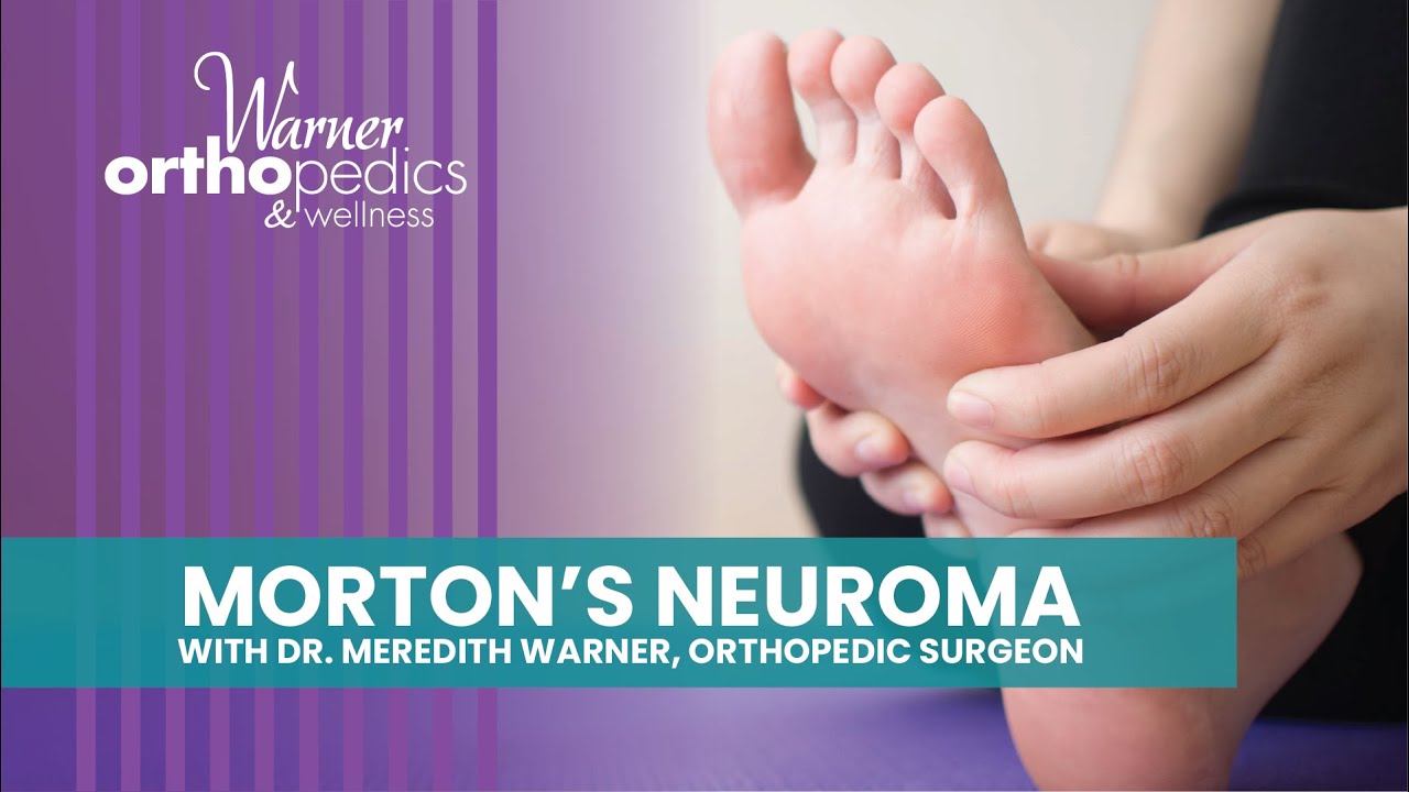 Morton's Neuroma Seminar