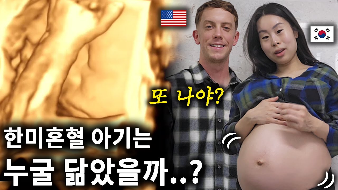 과연 한미 혼혈 아기 얼굴은 누굴 닮았을까..? 두 달 후 둘째 출산..😧