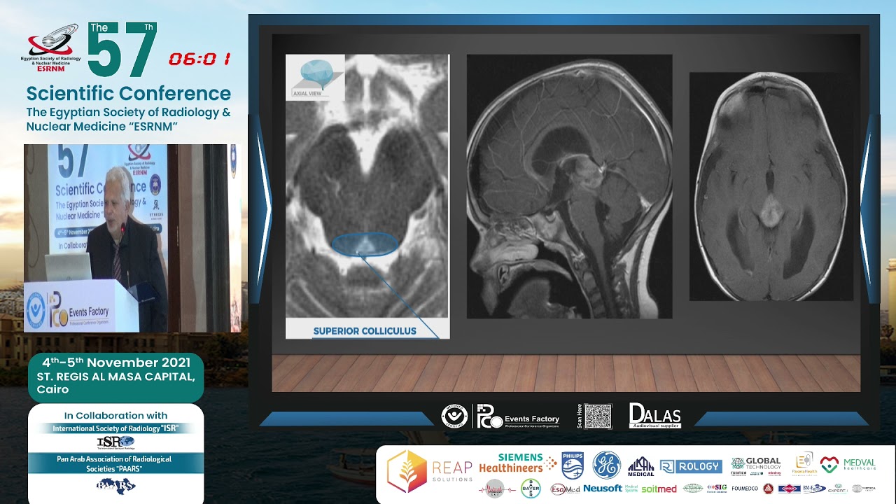 Recent Updates of Role of MRI in Brain Stem Lesions