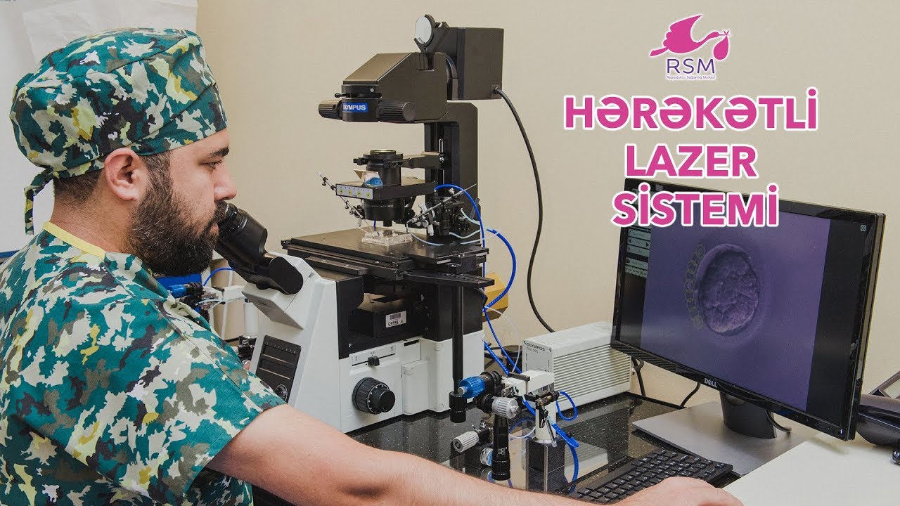 Hərəkətli lazer sistemi