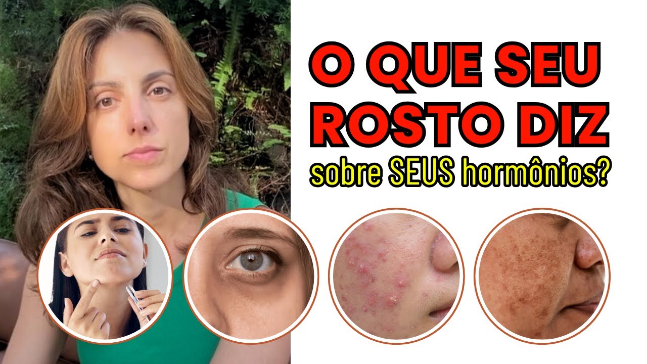 Seu ROSTO está te avisando! 😳 O que ACNE, INCHAÇO e MANCHAS dizem sobre seus HORMÔNIOS 💥