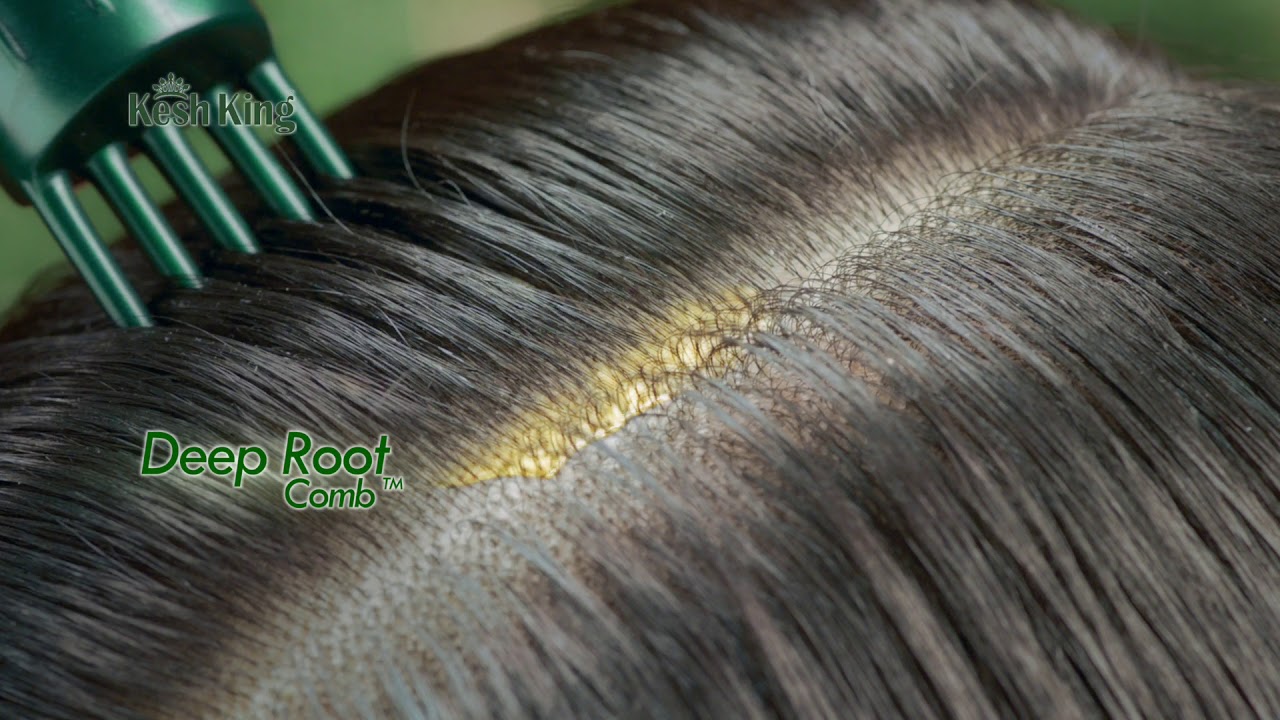 Kesh King Hair Oil | Best Ayurvedic Hair Oil now with a revolutionary Deep Root Comb
