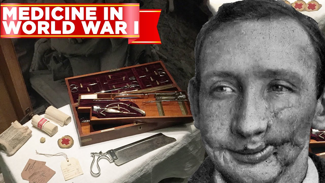 What Medicine Was like During World War 1