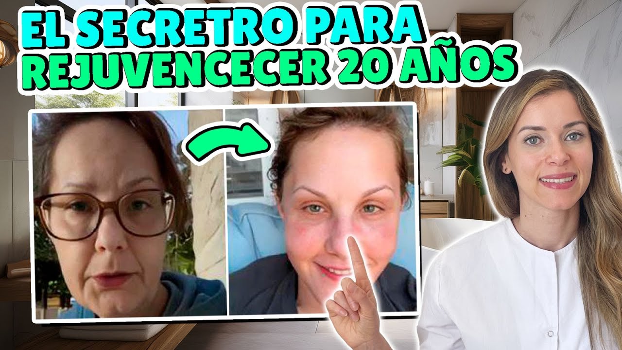 ¡Despídete de las arrugas con estos consejos!