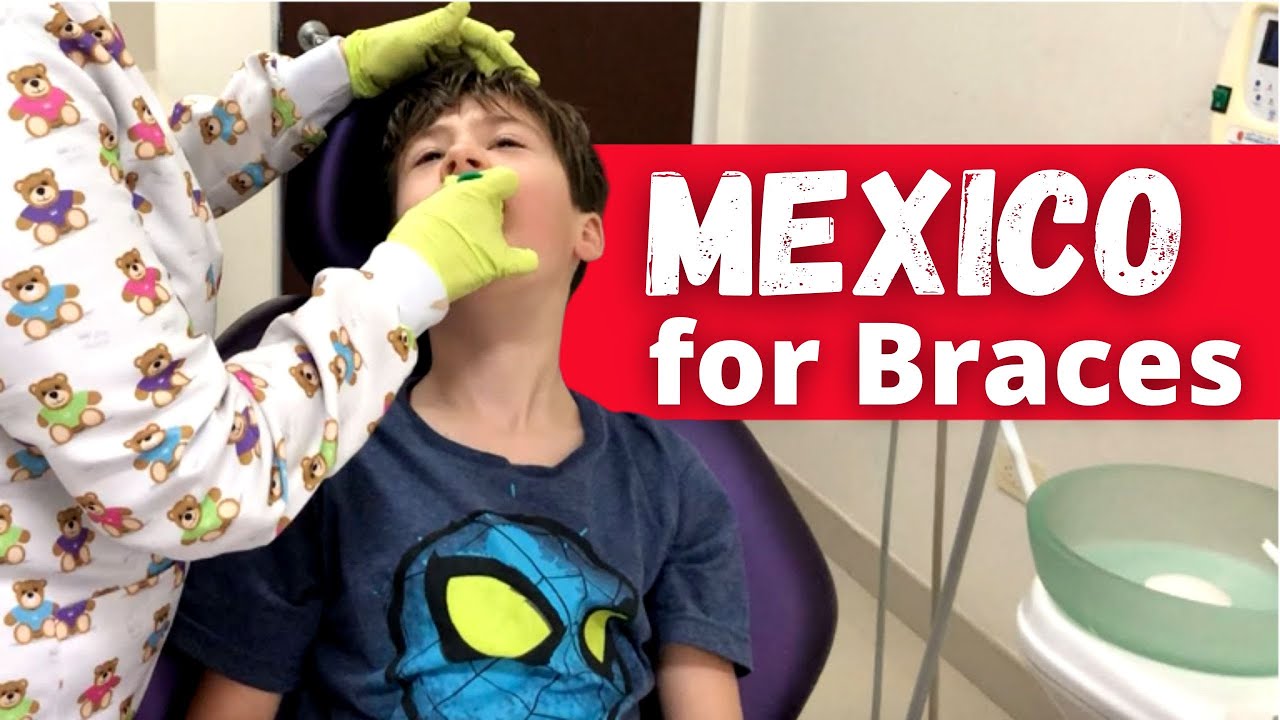 Getting Braces in Mexico (part 1)!