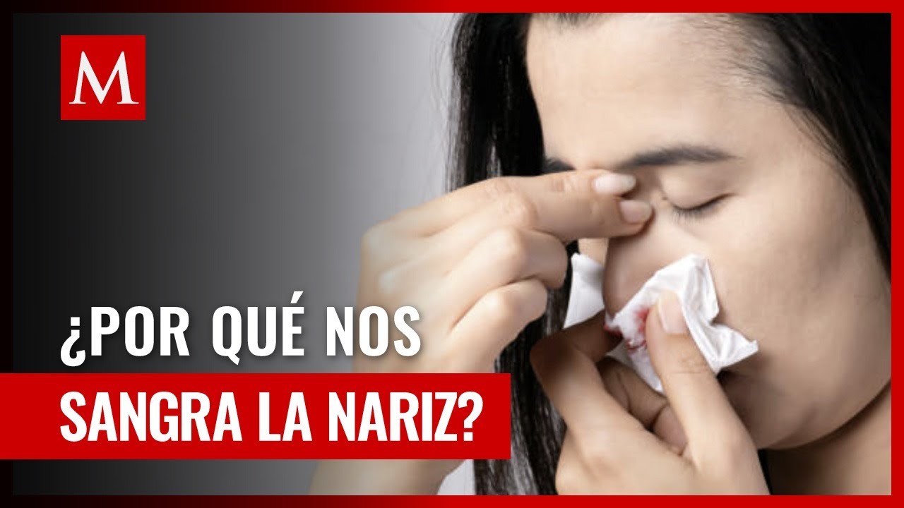Hemorragia nasal: &iquest;Por qu&eacute; ocurre durante el calor? Descubre la raz&oacute;n