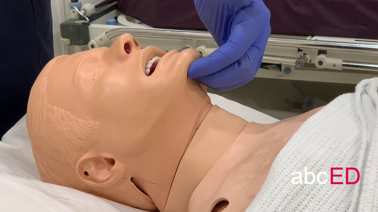 Basic Airway Manouvers and Airway Adjuncts