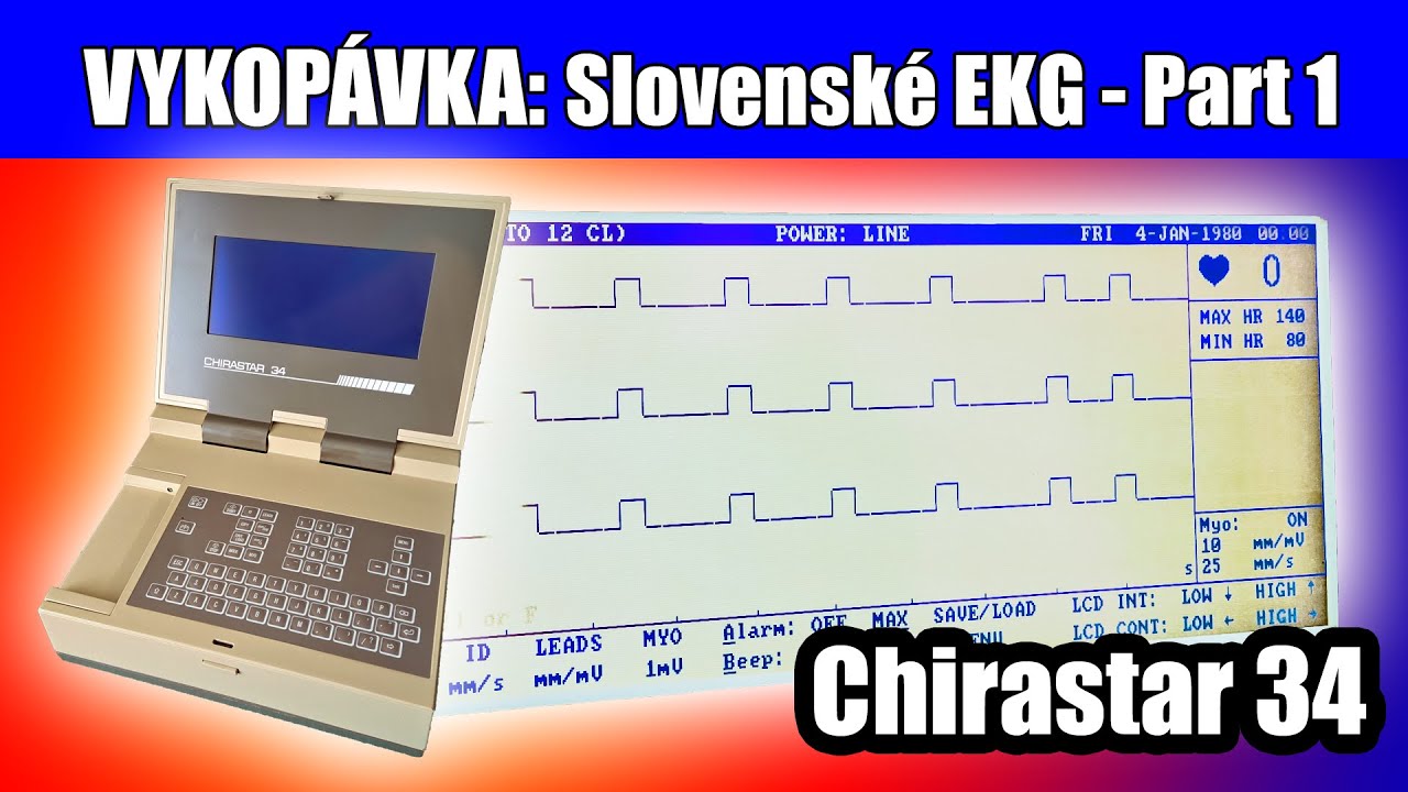 Slovenské EKG - Chirastar 34 [Part 1/2] [Vykopávka] [Retro-Tech] [ep28]