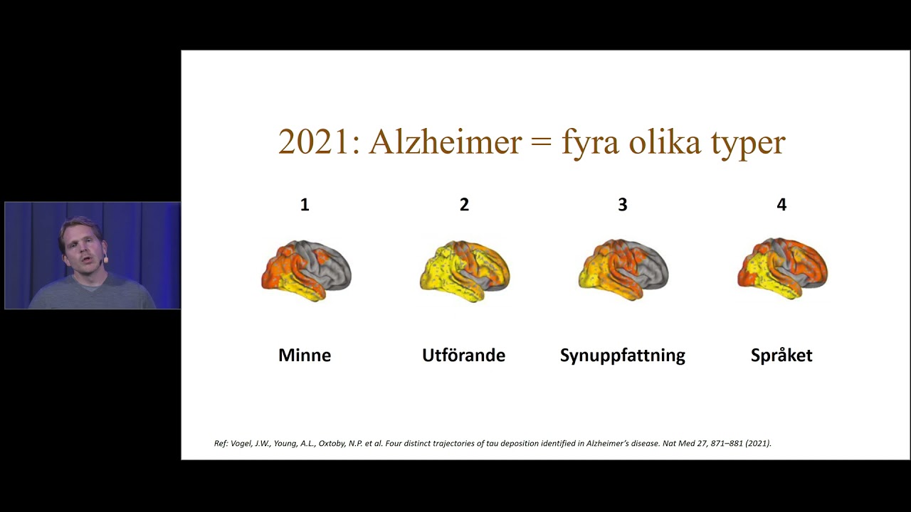 Vad är Alzheimers sjukdom och varför drabbas man? (Webinar: När minnet sviktar eller leder gör ont)