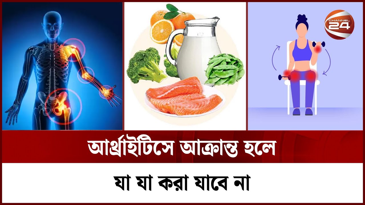 আর্থ্রাইটিসের ব্যথা থেকে মুক্তির উপায় | Arthritis | Channel 24 | Health Tips