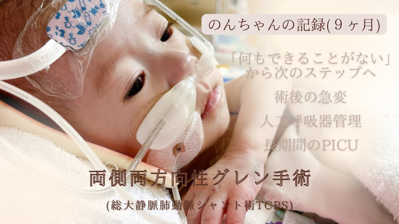 【先天性心疾患】心臓病｜グレン手術｜TCPS手術｜急変｜人工呼吸器管理