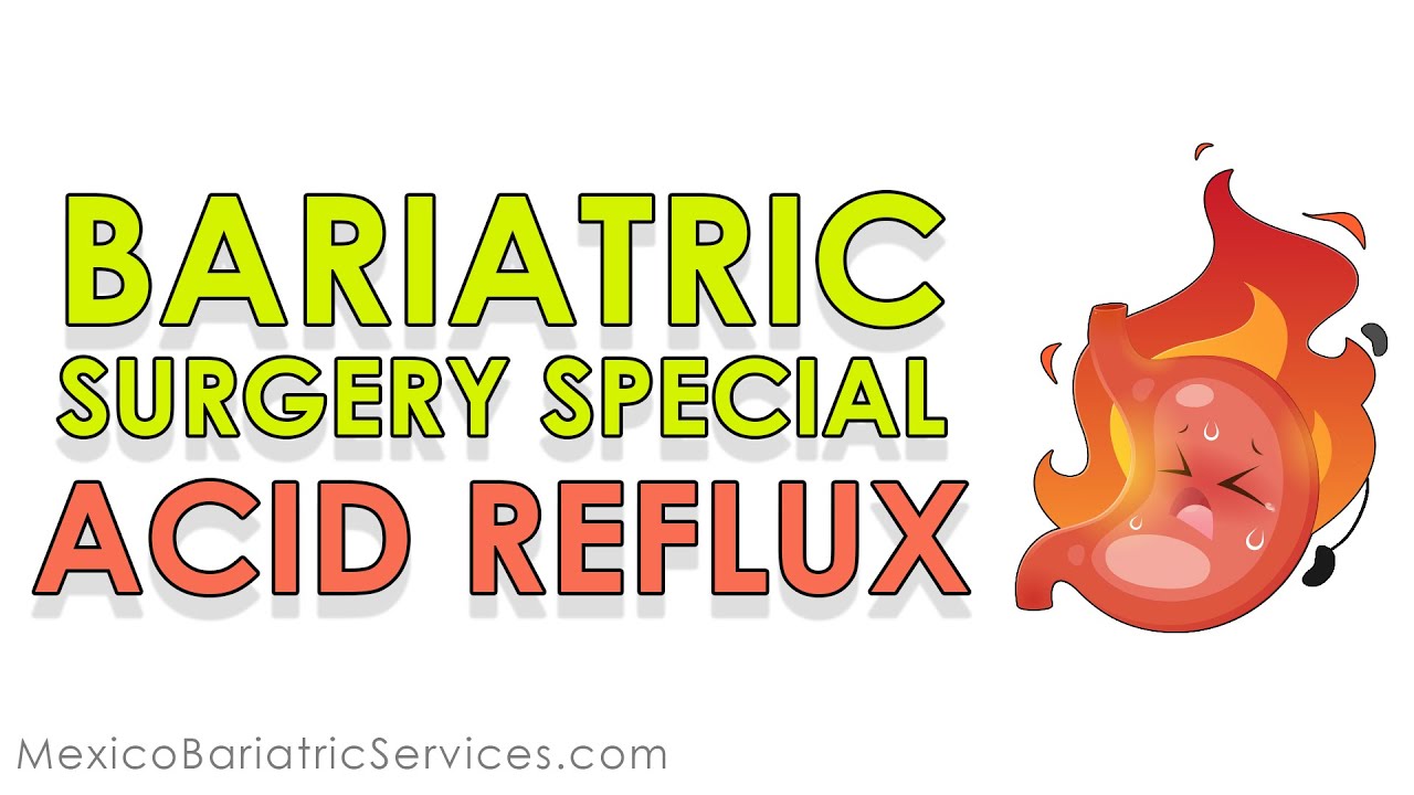 What is Acid Reflux? [How Does it Happen] | Bariatric Surgery |  Mexico Bariatric Services