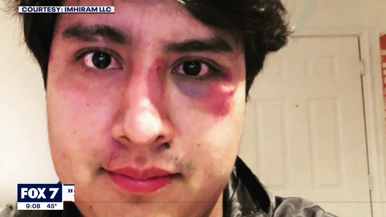 Citizen journalist attacked during demonstration home from the hospital