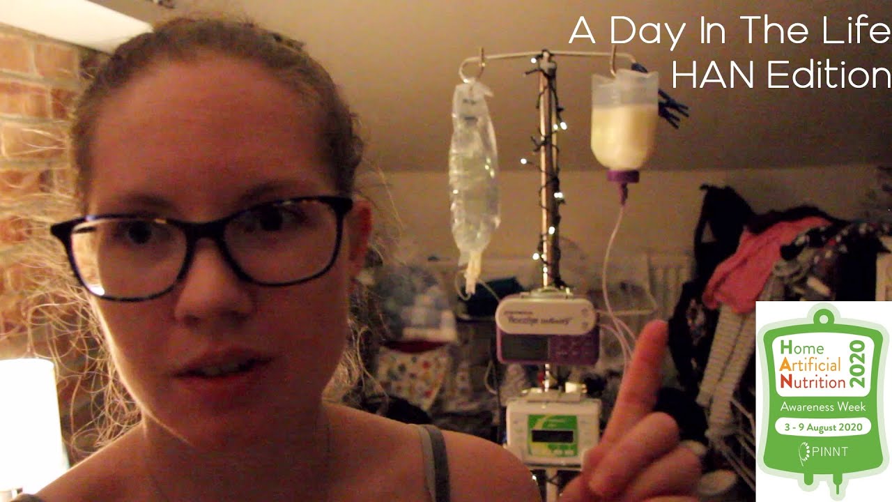 A Day In The Life With Artificial Nutrition